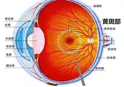 老年人眼底出血要根據(jù)綜合身體情況來診療